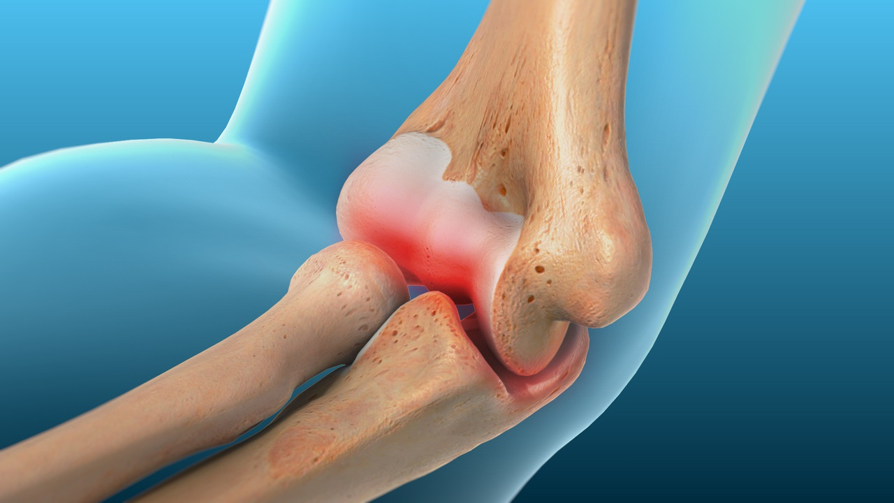 3 Types of Elbow Injuries and When To Treat Them