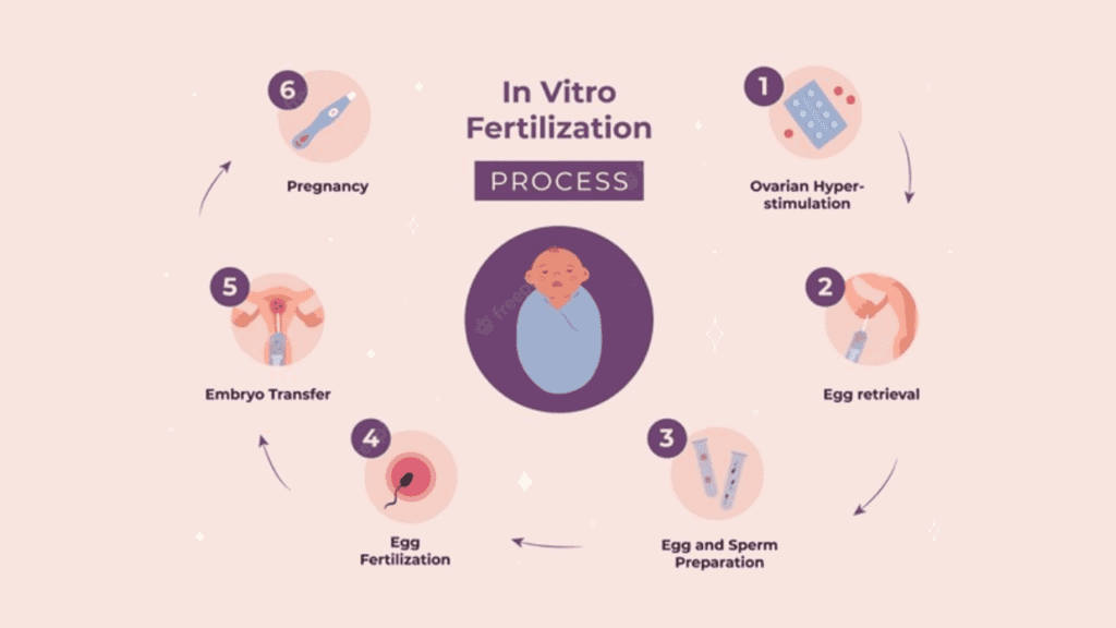 The 3 Steps of IVF